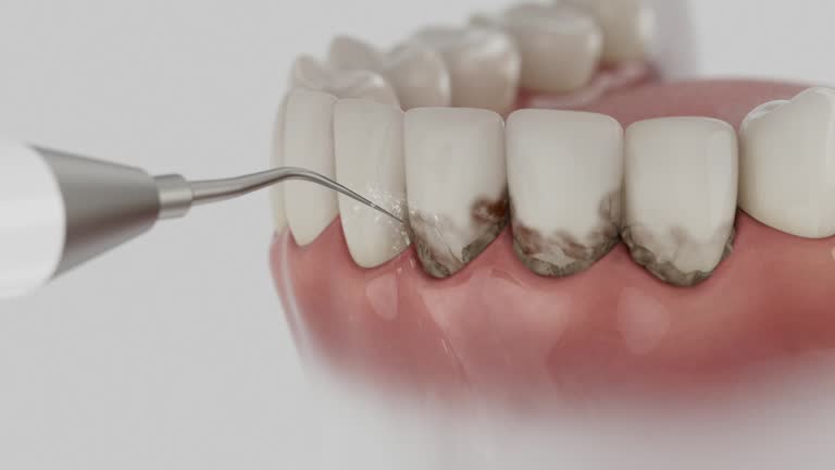 Trusted Teeth Cleaning And Checkup service in Brookhaven, PA - Dentist Open Now